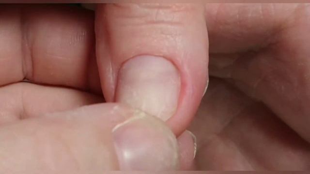 Удивление на десерт? Наращивание на[скобообразную форму] смотреть онлайн