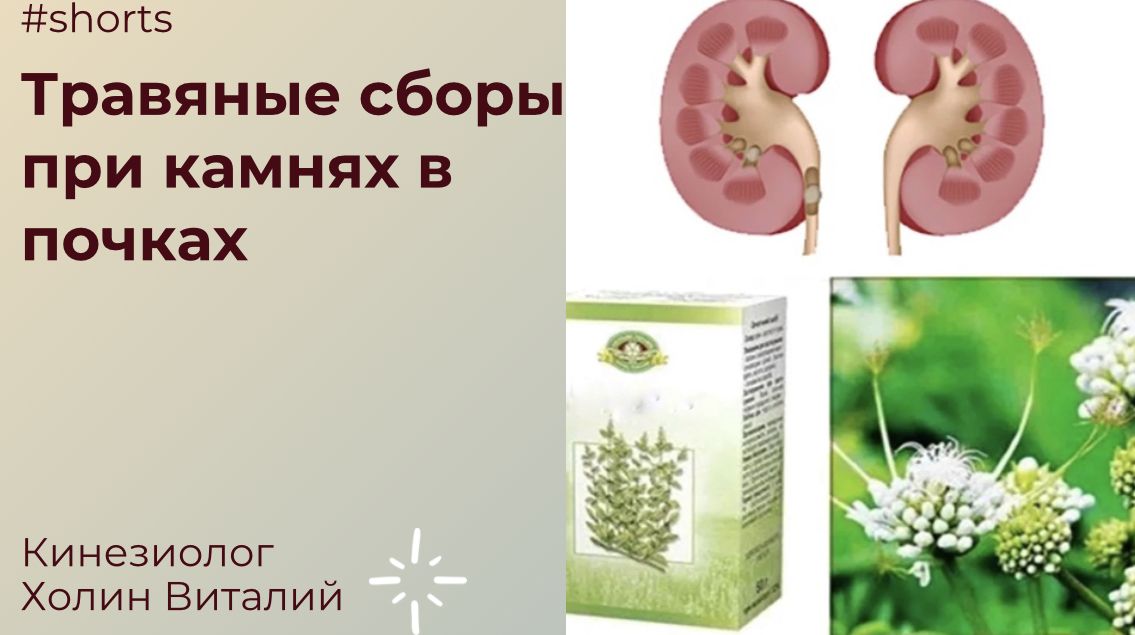 Травяные сборы при камнях в почках смотреть онлайн