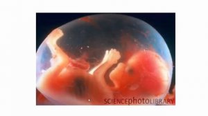 15 Пятнадцатая неделя беременности