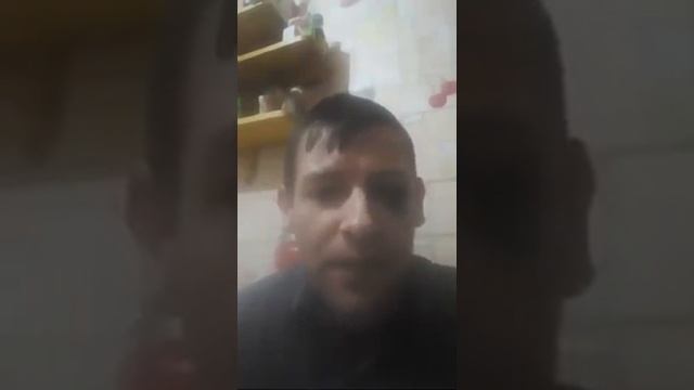 Синяк Под Глазом смотреть онлайн