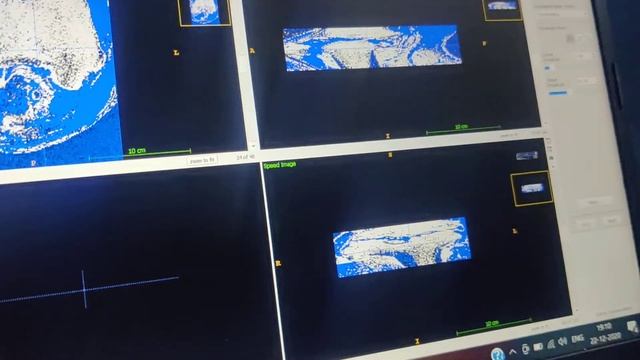 ITK snap: Image segmentation of Knee using Active contour and creating 3d Model смотреть онлайн