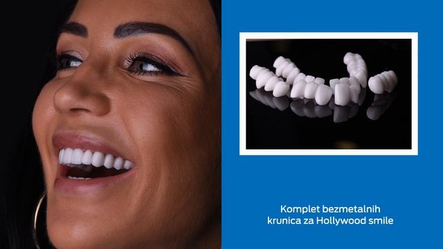 Hollywood smile, Bleach 2 смотреть онлайн
