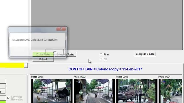 EndoRecord Indonesia C7 Cara Export Data ke Excel смотреть онлайн