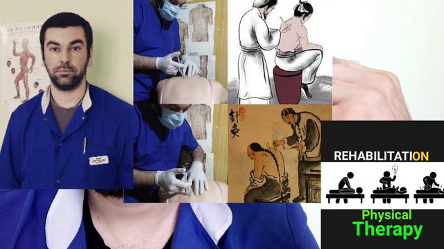 существуют ли точки АКУПУНКТУРЫ ? смотреть онлайн