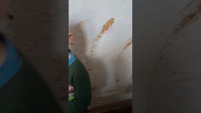 рука болит)))) смотреть онлайн