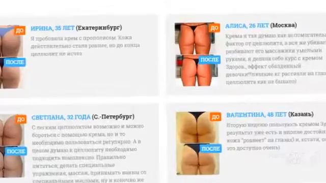 какие крема помогают от целлюлита смотреть онлайн