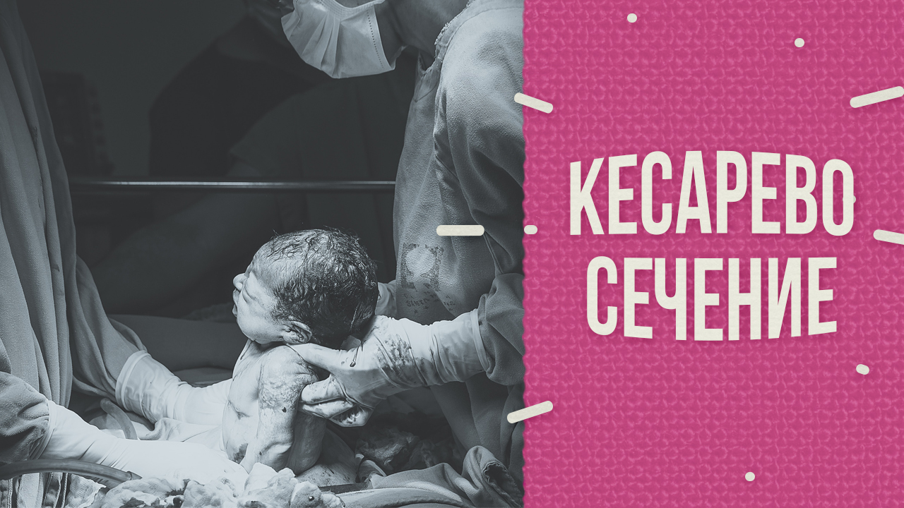 Кесарево как выход смотреть онлайн