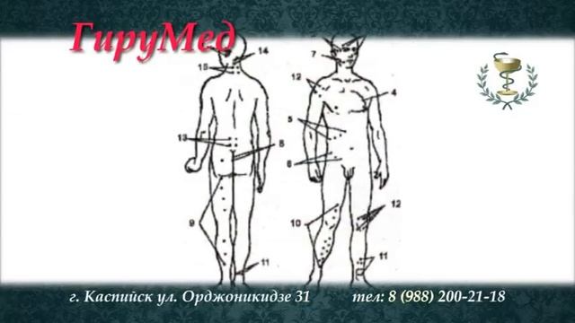 Реклама Гирумед смотреть онлайн