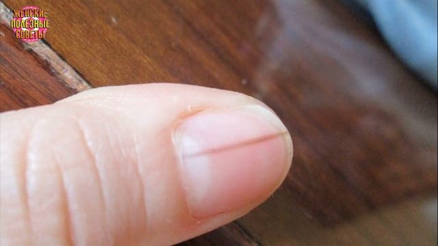 ЕСЛИ ВЫ ВИДИТЕ ЧЕРНУЮ ЛИНИЮ НА НОГАХ ЧЕЛОВЕКА, НЕМЕДЛЕННО ВЫЗОВИТЕ СКОРУЮ, ЭТО МОЖЕТ СПАСТИ ЖИЗНЬ! смотреть онлайн