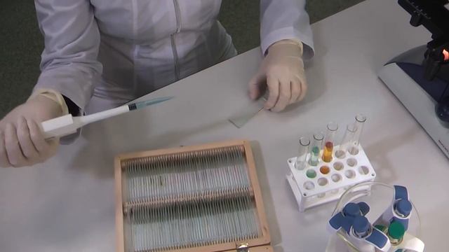Просто о сложном. Почему нельзя есть продукты с плесенью? смотреть онлайн