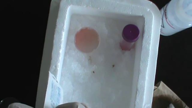 Harvesting Mouse Spleen Cells смотреть онлайн
