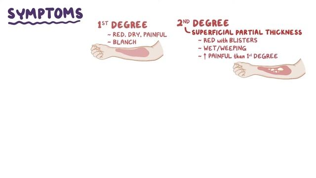 Ожоговая Травма смотреть онлайн