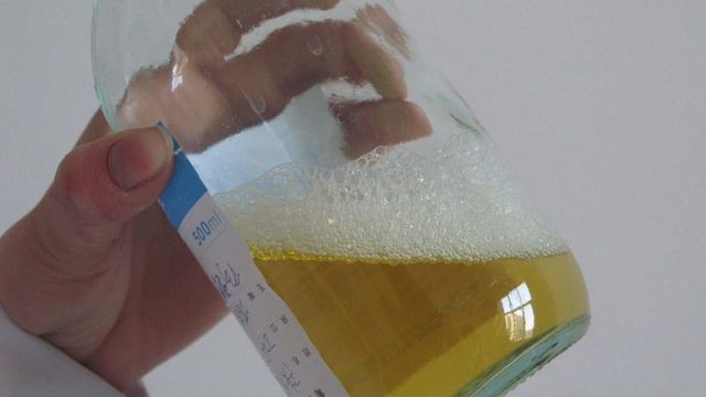 Бүйрек өліп жатыр. Алғашқы белгілерін жіберіп алмаңыз. смотреть онлайн