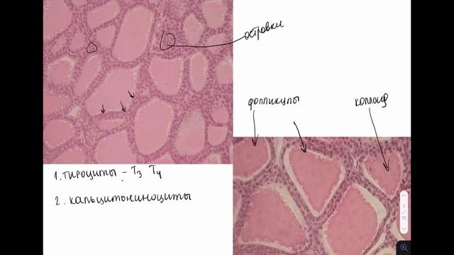 Щитовидная железа и паращитовидная железа | Разбор гистологического препарата смотреть онлайн