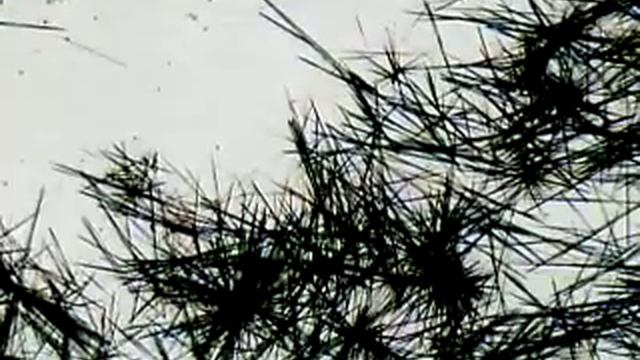 URINARY CRYSTALS - Tyrosine Crystals смотреть онлайн