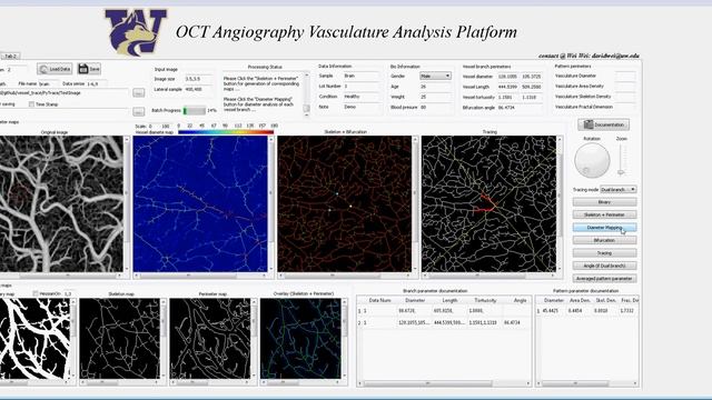 OCT angiography vasculature analysis GUI platform (Python 3.7 + PyQt5) смотреть онлайн