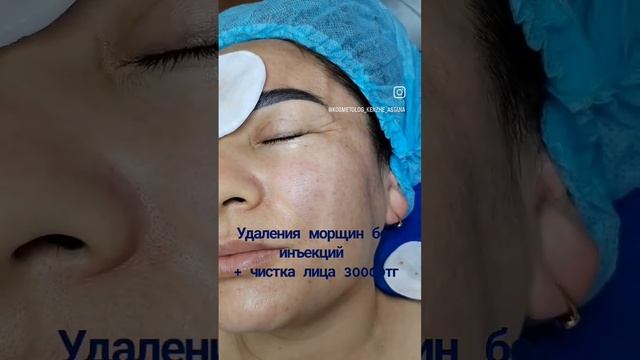 Инесіз әжім кетіру! Астана қаласы, Жургенова 34. ?8776-841-09-87 смотреть онлайн
