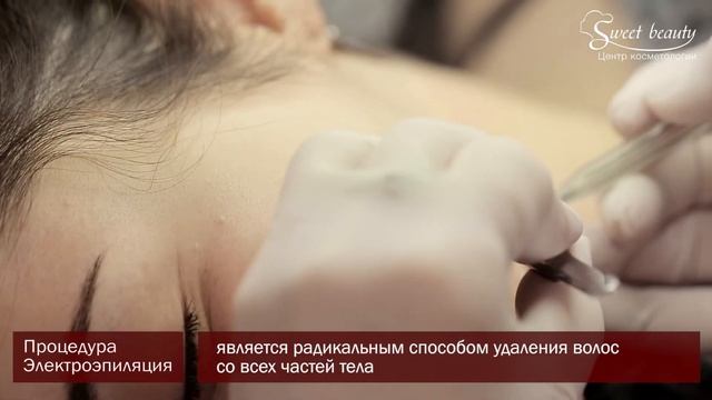 Электроэпиляция смотреть онлайн