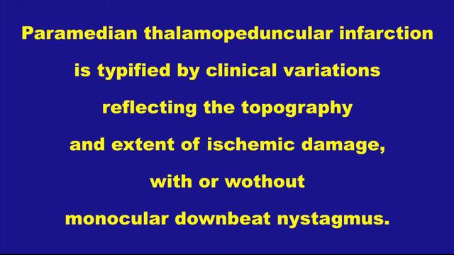 Mochizuki-Oishi Syndrome.mov