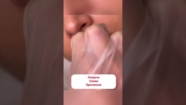 Збільшення губ у техніці Instagram lips. Онлайн навчання по губам лише 100$ смотреть онлайн