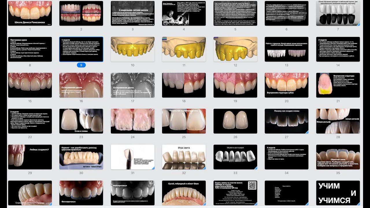 Вебинар разбор работ зубных техников, ссылка в описании смотреть онлайн
