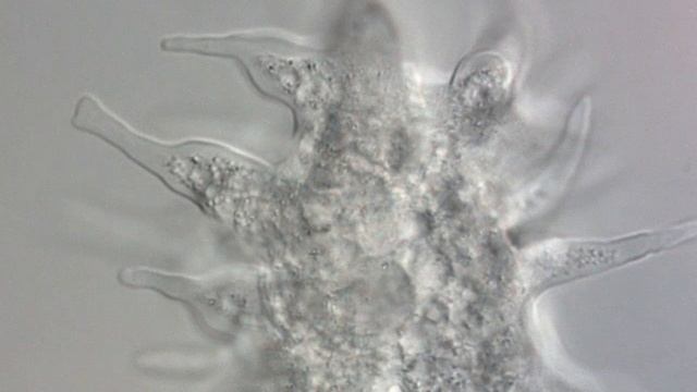 POLYCHAOS fasciculatum like Sp. / AMOEBA annulata Penard 1902 смотреть онлайн