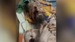 Покалеченный медведем россиянин месяц пролежал с ним в берлоге ,вот что с ним стало