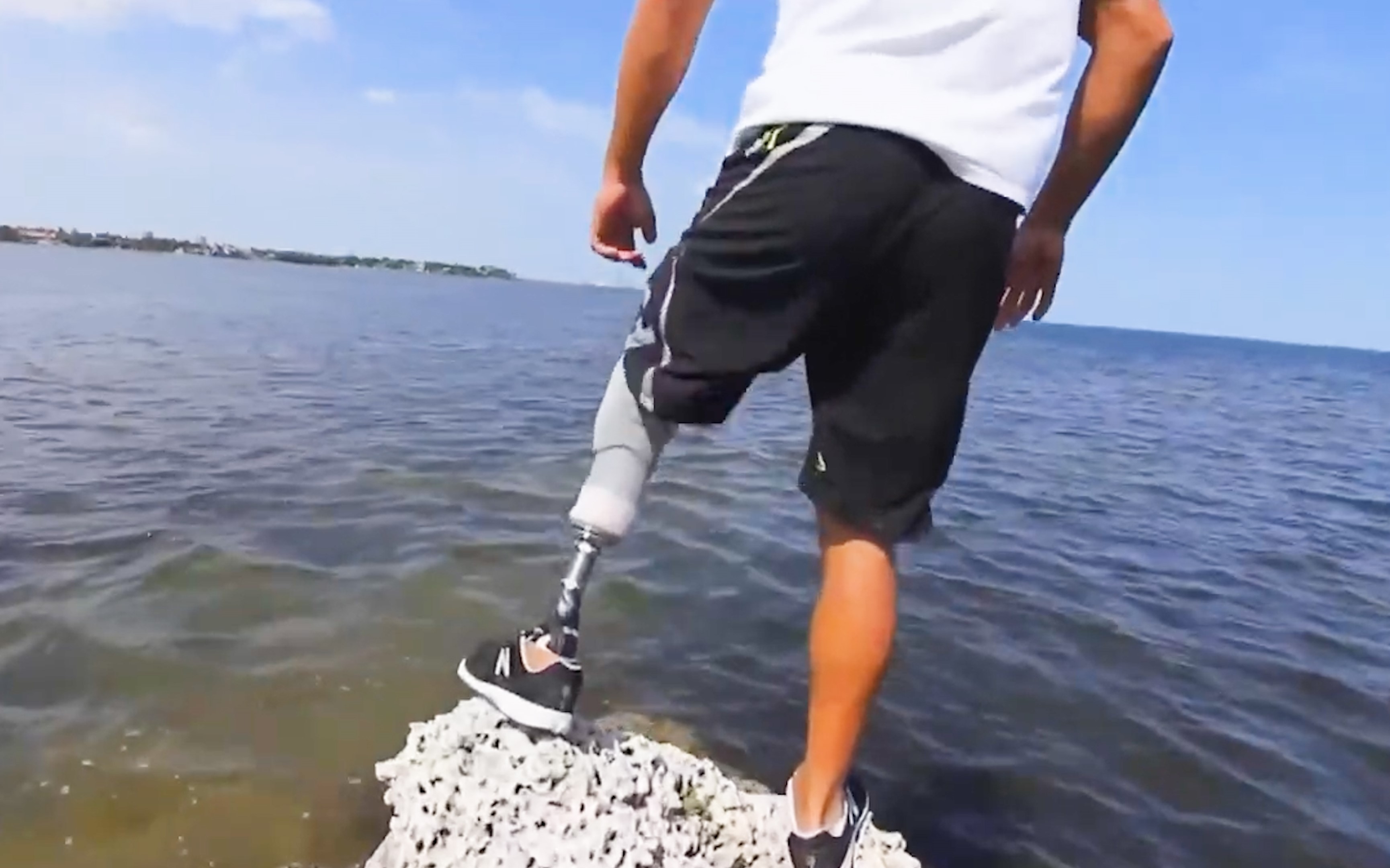 Протез голени в XXI веке смотреть онлайн