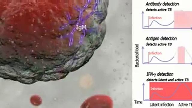 Learning Zone Movie 3 - IGRAs (Interferon Gamma Release Assay) смотреть онлайн