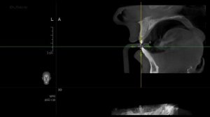 EZ3D2009 (просмотр КТ) - инструкция пользователя