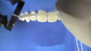 Работа с Коффердамом (Обучающее видео для стоматологов)