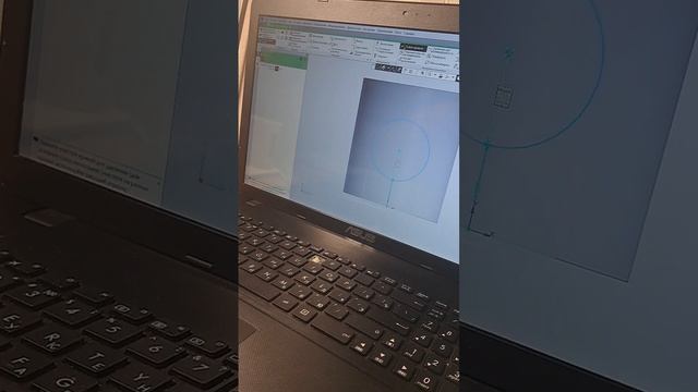 Вариант 1 ИКГ смотреть онлайн