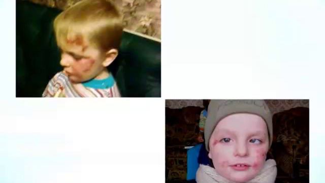26.11.14 Школа здоровья. "Паразиты вокруг нас." смотреть онлайн