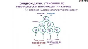 Синдром Дауна - причины, симптомы, диагностика - кратко