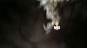чистка перхоти - Scalp dandruff preparation - dandruff hair cleaning - removendo caspas