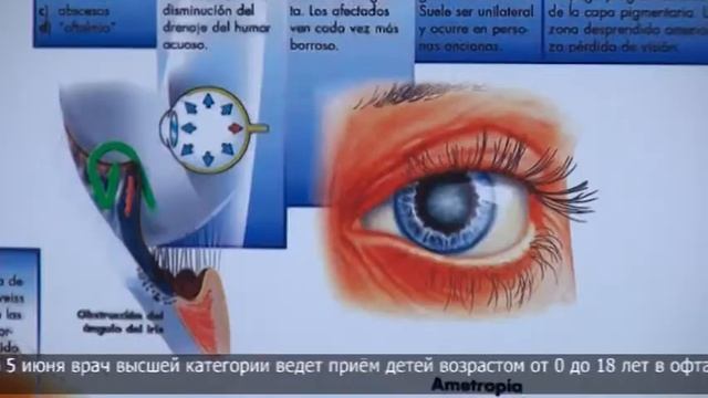 Детский врач офтальмолог из Алматы ведет прием пациентов в Петропавловске смотреть онлайн
