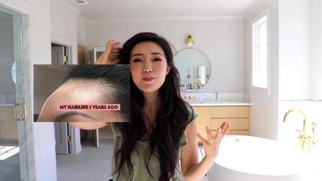 Scalp Microblading For Hair Loss + Cost смотреть онлайн