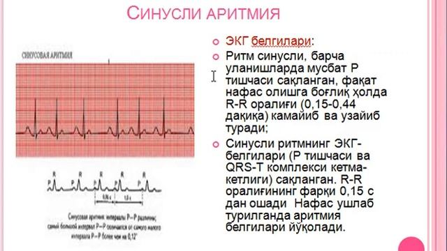 Юрак аритмиялари 1 қисм смотреть онлайн