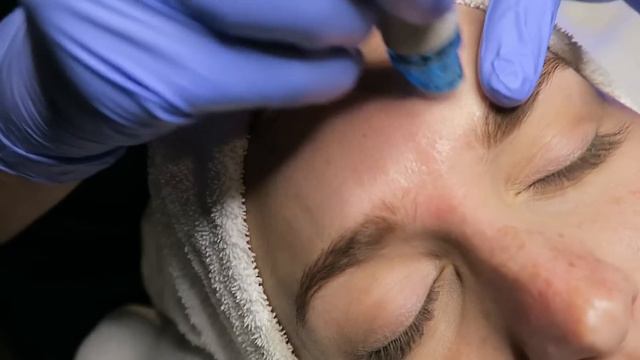 Getting My Pores SUCKED CLEAN! My First Hydra Facial Experience смотреть онлайн