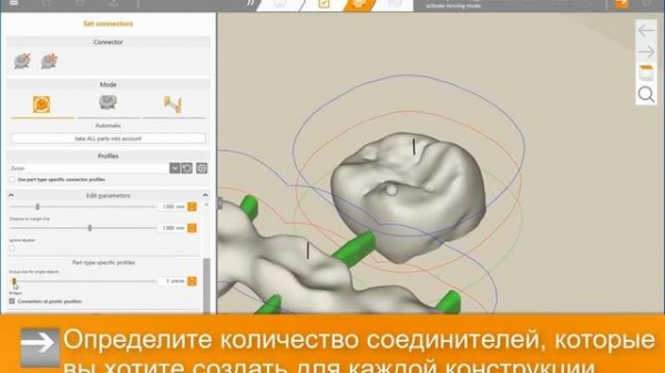 функционал hyperDENT RU - Соединители. Создание и измененение
