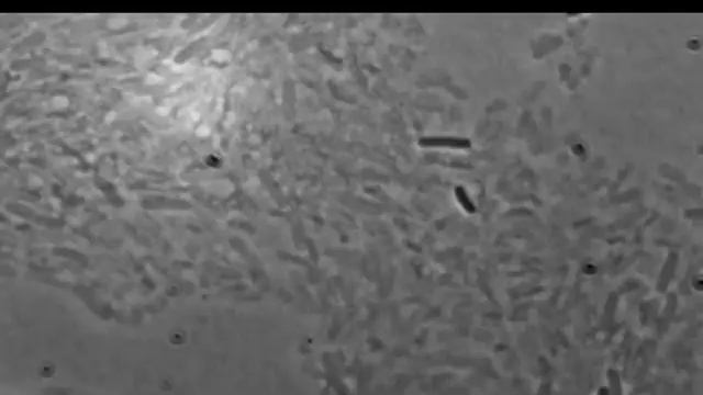 Exploding E. coli смотреть онлайн