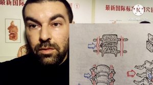 головокружение из за грыжи позвоночника в шейном отделе