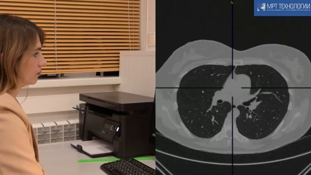 МСКТ органов грудной клетки смотреть онлайн