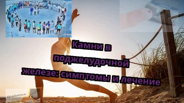 Камни в поджелудочной железе: симптомы и лечение смотреть онлайн