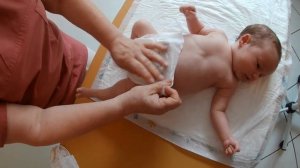 Дисплазия тазобедренного сустава у новорожденных. Широкое пеленание.