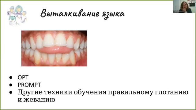 Задай ? логопеду - Самостимуляция у ребенка с РАС или неправильный прикус? смотреть онлайн