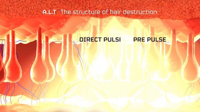 Leonardo Hyper Pulse смотреть онлайн