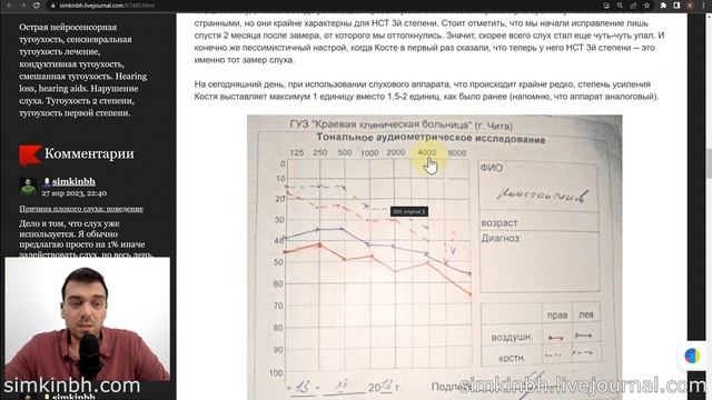 Улучшение до +35дБ на аудиограмме: разбор первых исправлений слуха №2 (2013-2014) смотреть онлайн