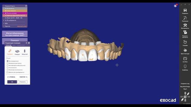 Как вернуть жёлтые модели зубов в ExoCAD? смотреть онлайн