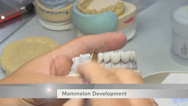 IPS eMax Veneers смотреть онлайн